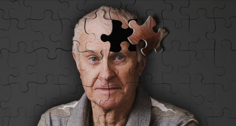 Alzheimer: Síntomas, Causas Y Tratamientos - Aido.es